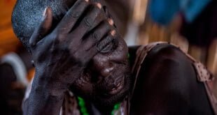 Niño sursudanés víctima de la violencia. Foto de archivo: UNICEF/South Sudan/Sebastian Rich
