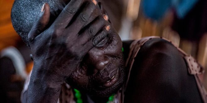 Niño sursudanés víctima de la violencia. Foto de archivo: UNICEF/South Sudan/Sebastian Rich